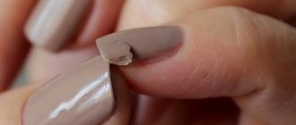 What to do if a nail is broken, how to fix it under gel polish, extensions