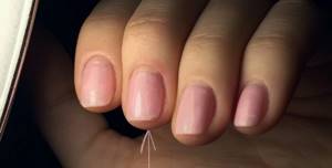 What to do if flaws appear in the manicure coating