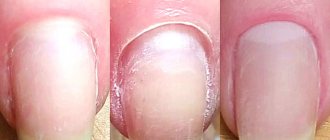 Stages of cuticle removal in classic manicure