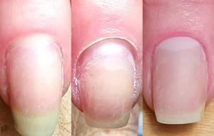 Stages of cuticle removal in classic manicure