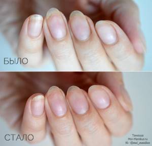 European manicure: before and after photos