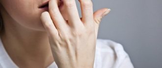 Как перестать грызть ногти