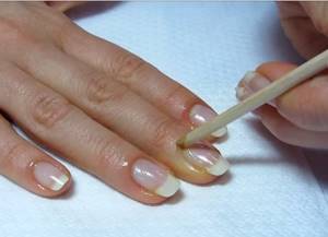 How to remove cuticle