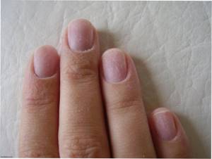 How to restore nails