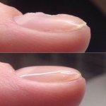 How to level the nail plate with a base for gel polish