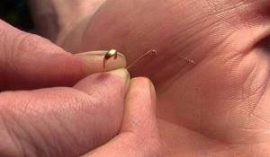 How to remove a splinter using a needle