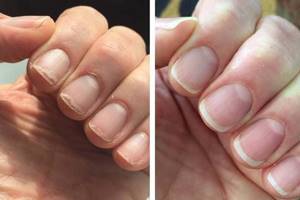 When do you need to straighten your nails?