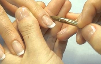 Correction of acrylic nails