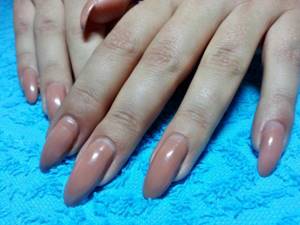 nail correction with gel