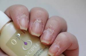 best cuticle remover reviews