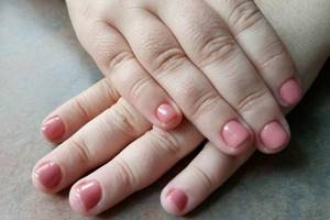 Manicure for thick fingers, short, wide nails. Photo 