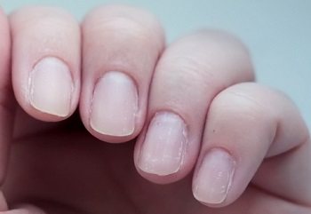 Manicure on thin, weakened nails fades very quickly