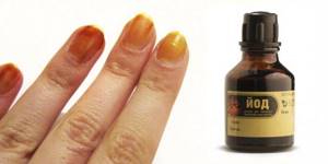 Nail mask with iodine