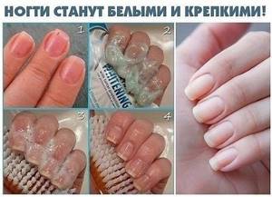 Masks for strengthening nails at home. Traditional methods and recipes, vitamins 