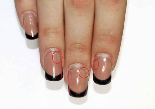 Nails in need of correction