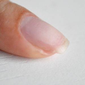 degreasing a broken nail