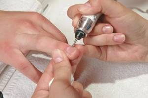 Treatment of the lateral sinuses in a combined manicure