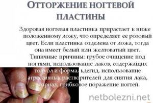 Отторжение ногтевой пластины