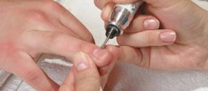 Causes of ridged fingernails