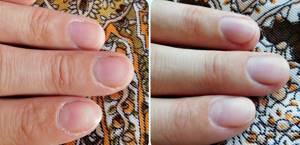 cuticle remover reviews which is better