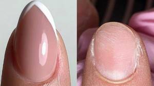 Result after nail extensions on forms