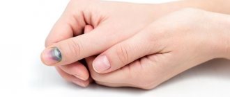 The index and thumb are injured more often than other fingers.