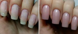 Strengthening nails with acrylic, before and after photos