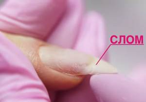 We eliminate all defects on nails
