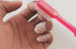 Toothpaste for whitening nails.